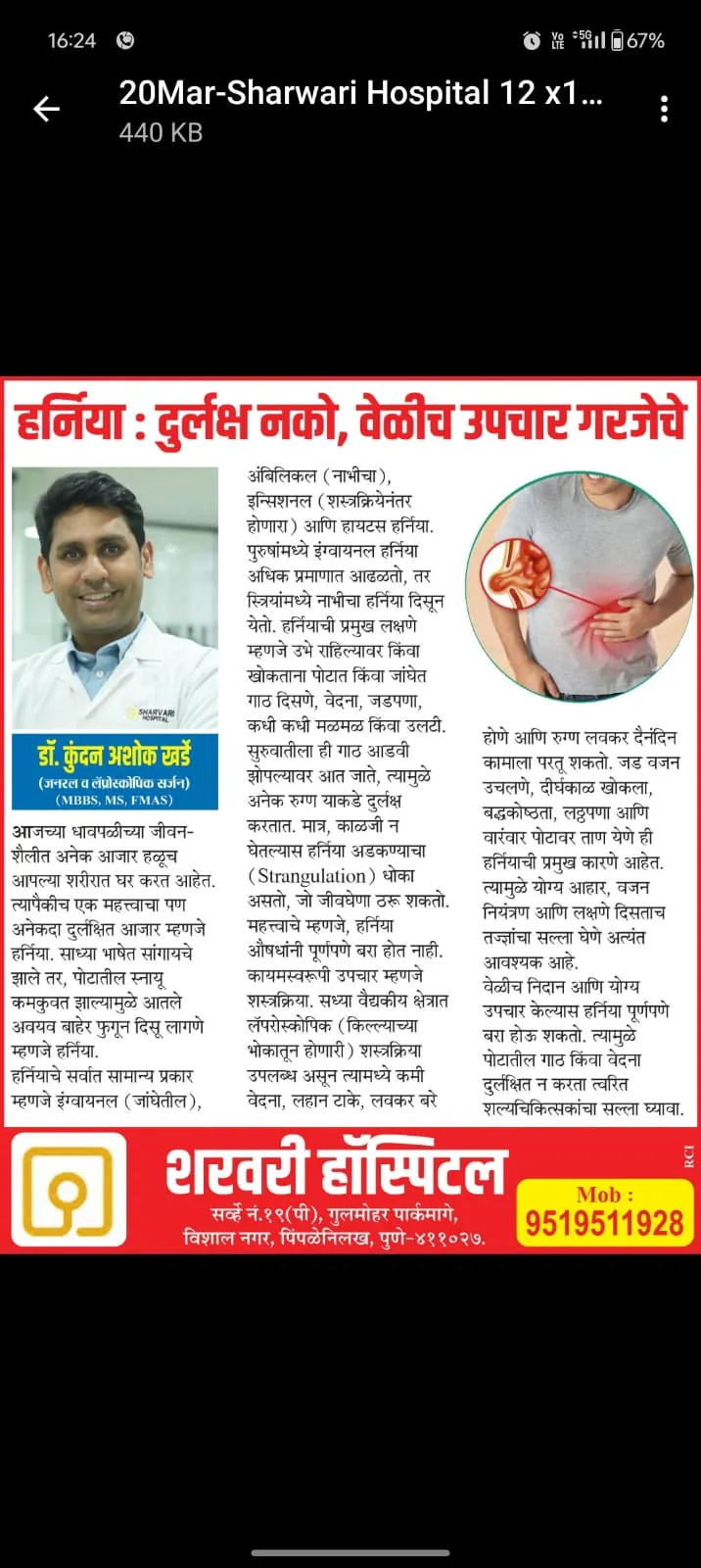 Lokmat 20 Mar 2025 — Dr. Kundan Kharde column on hernia