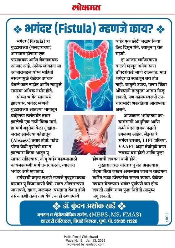 Lokmat 13 Jan 2026 — Dr. Kundan Kharde column on anal fistula (bhagandar)